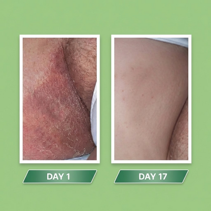 Velassi Antifungal Soap